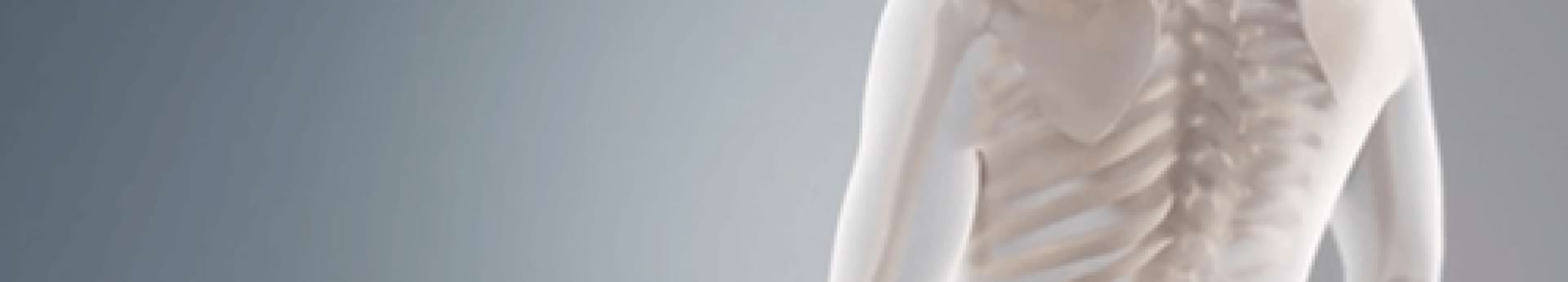 knochenumbau-beim-multiplen-myelom