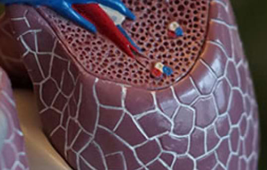 nsclc-beim-asco-2023-sotorasib