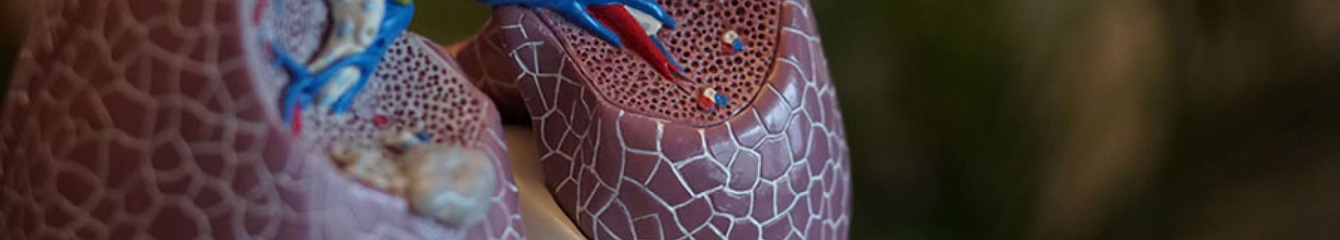 nsclc-beim-asco-2023-sotorasib