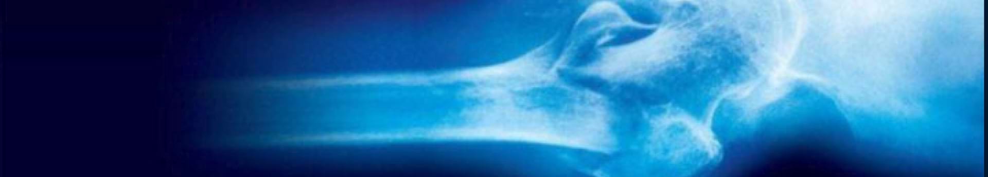 bone-academy-maennerknochen