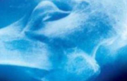 bone-academy-maennerknochen